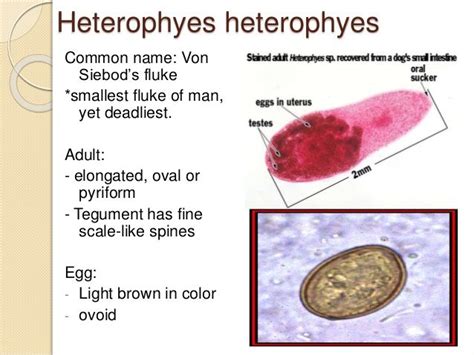  Heterophyes Heterophyes: Can This Tiny Fluke Really Make You Sick Through Undercooked Fish?