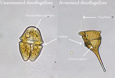  Armored Dinoflagellates: Are These Tiny Treasures Hiding Beneath a Protective Shell?