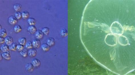  Just What Are These Tiny Jellyfish-Like Parasites Lurking Within Our Cells? 