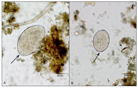  Quizzing Quingxius:  Unraveling the Mysteries of This Fascinating Trematode Parasite!