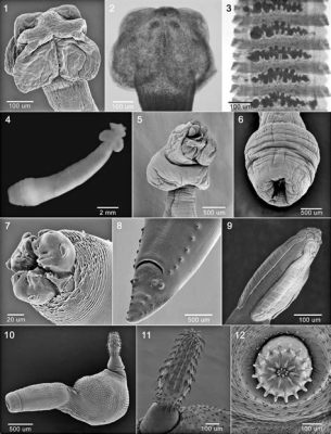  Tetrabothrius! A Worm That Lives Like It's on a Never-Ending Road Trip Through a Mammal's Gut