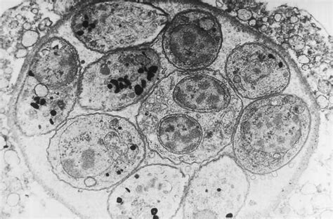  Toxoplasma Gondii: Can This Tiny Parasite Control the Minds of Its Hosts?